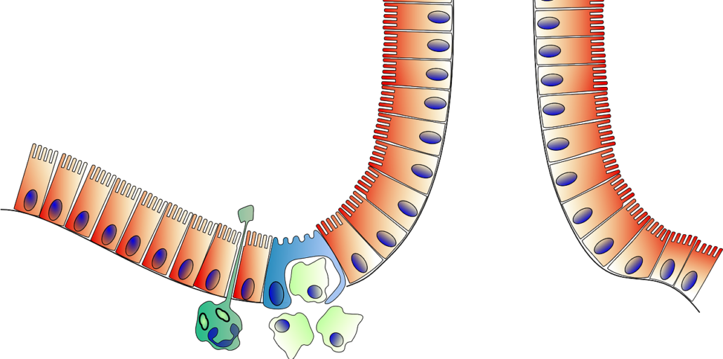 Leaky Gut